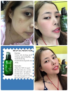 Serum thay da nhân sâm