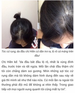 MAXXHAIR- Ngăn rụng tóc/giúp tóc mọc nhanh
