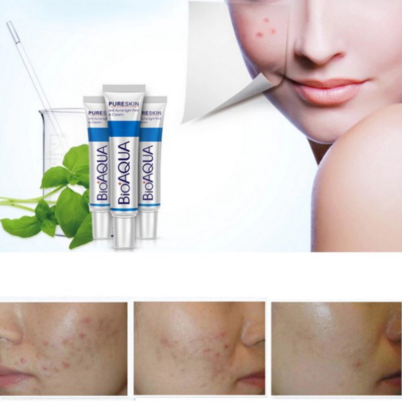 BIOAQUA Anti Acne Cream Oil Control Shrink Pores Scar Remove