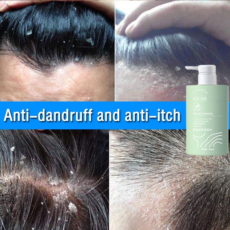 Dầu gội đầu muối biển dầu gội đầu loại bỏ gàu dầu gội loại bỏ tế bào chết dầu gội chống ngứa 500ml loại bỏ ngứa ngáy