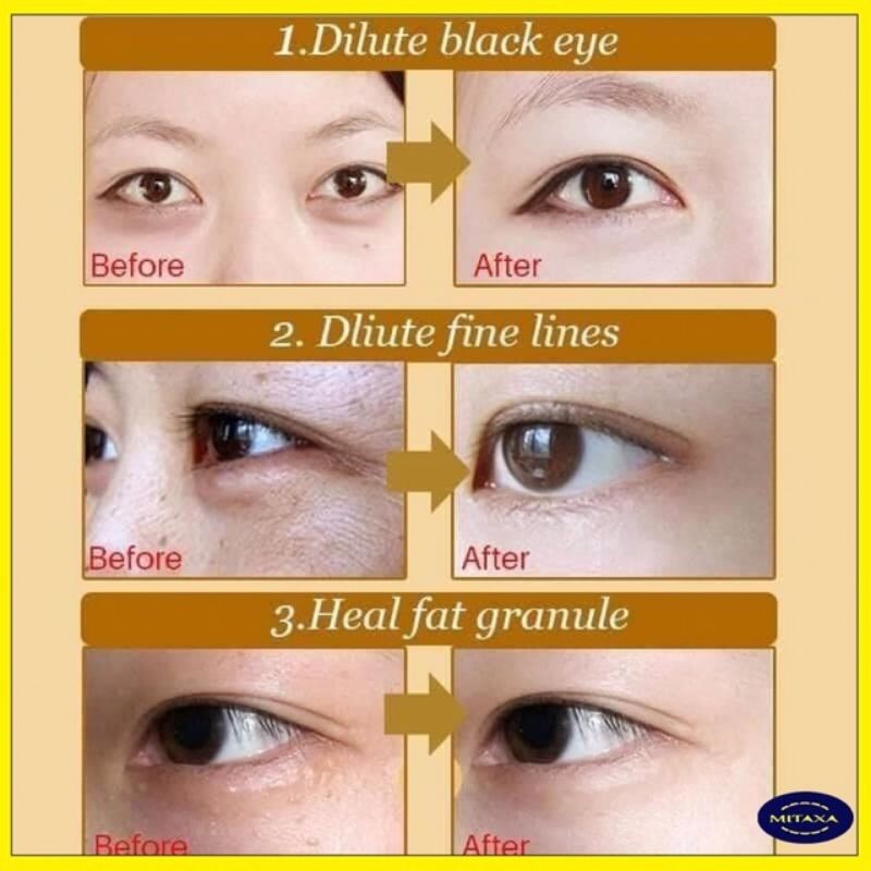 Mắt nạ mắt collagen vàng giảm thâm mắt loại bỏ nếp nhăn | BigBuy360 - bigbuy360.vn