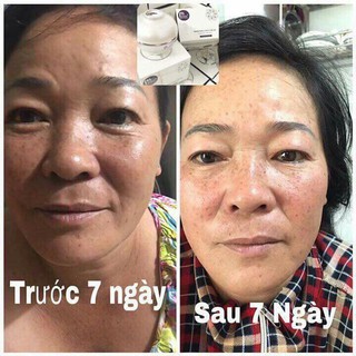 Kem Face Dạng Thạch