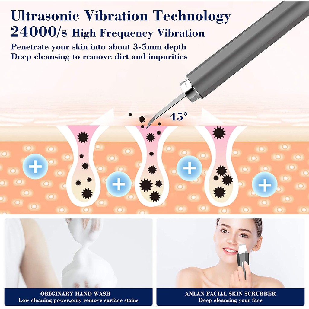 [Mã FMCG100K - 10% đơn 500K] Máy Cà Da Anlan Ipx5 Siêu Âm Chống Nước Loại Bỏ Mụn Đầu Đen Ems Nâng Cơ Mặt 45 ℃ | BigBuy360 - bigbuy360.vn