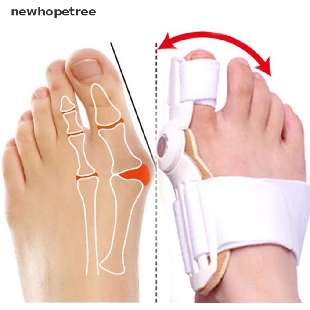 Đai định hình ngón chân cái giảm đau hiệu quả