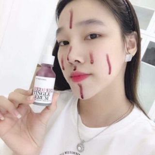 RED PEEL TINGLE SERUM