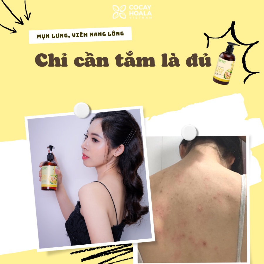 Chai Lớn 500gr - Sữa Tắm Thảo Dược Gừng Nghệ Trắng Da Giảm Mụn Thâm Giữ Ấm Cơ Thể Cỏ Cây Hoa Lá
