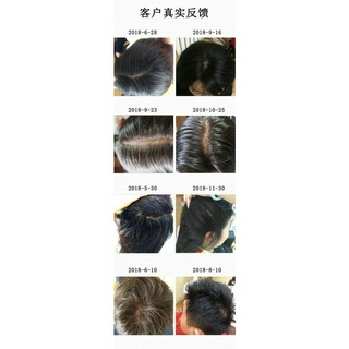 Dầu gội đầu cho tóc bạc thành tóc đen