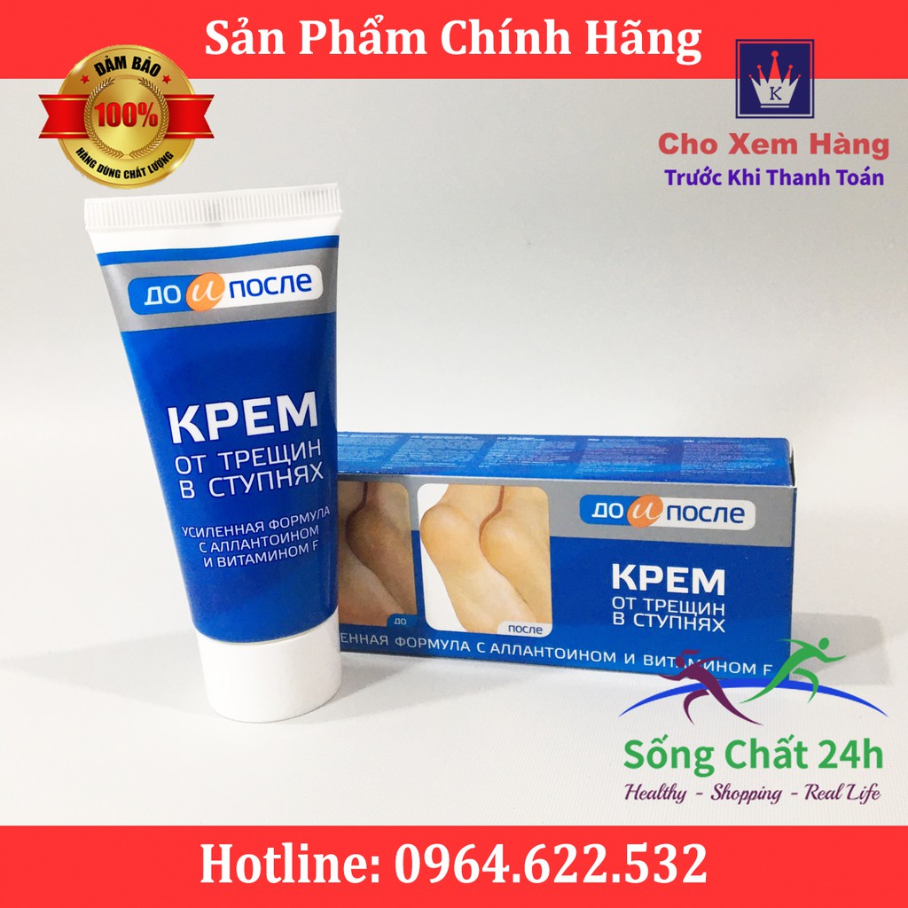 Kem Nứt Gót Chân Kpem Apteka Nga - Sống Chất 24h