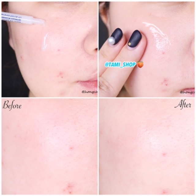 Tinh Chất Làm Trắng Neogen Sur.Medic+ Super Glutathion 100 Bright Ampoule