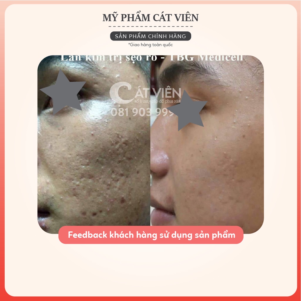 Tế Bào Gốc Cấp Ẩm Căng Bóng Phục Hồi Da, Serum Cá Hồi Extra Medicell - Lọ 5ml