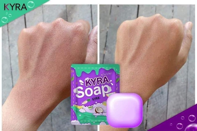 Xà Phòng Kyra Soap Trắng Da Body & Face | BigBuy360 - bigbuy360.vn