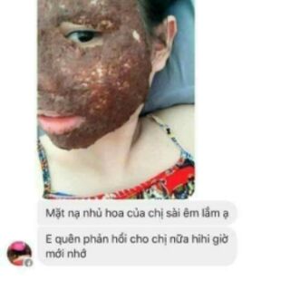 Ngũ hoa hạt 3NC