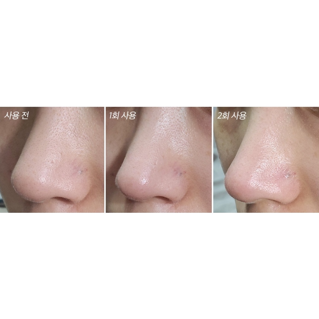 Mặt nạ Innisfree Volcanic Calming Pore Clay Mask 100ml