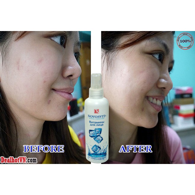 Xịt Khoáng Đá Lạnh Novosvit Nga 190Ml Cấp Ẩm Dịu Da Tăng Độ Đàn Hồi