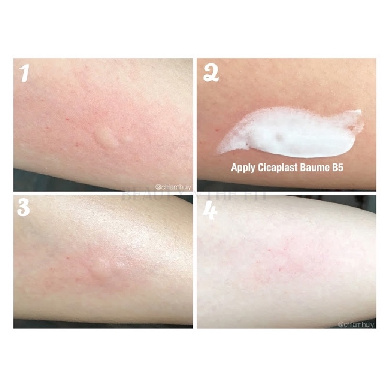 Kem Dưỡng Phục Hồi Da La Roche Posay Cicaplast Baume B5 | BigBuy360 - bigbuy360.vn