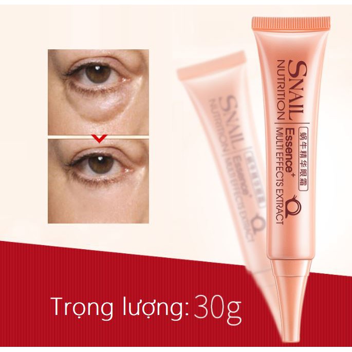 Kem mắt Laikou Snail Nutrition chống lão hóa tinh chất ốc sên