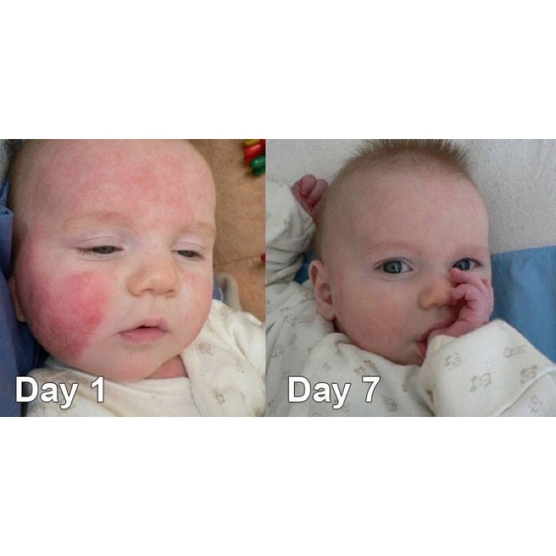 KEM DƯỠNG DA GLYCEROL VASELINE
