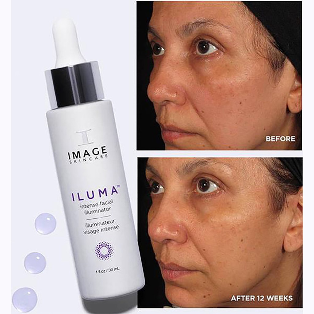 Image Iluma - Serum Sáng Da, Hỗ Trợ Mờ Thâm Nám Cấp Tốc 30ml