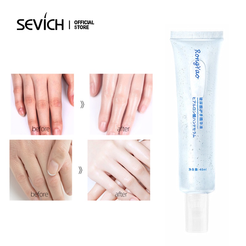 Kem dưỡng da tay SEVICH chứa tinh chất Hyaluronic Acid làm sáng tông màu da 40ml