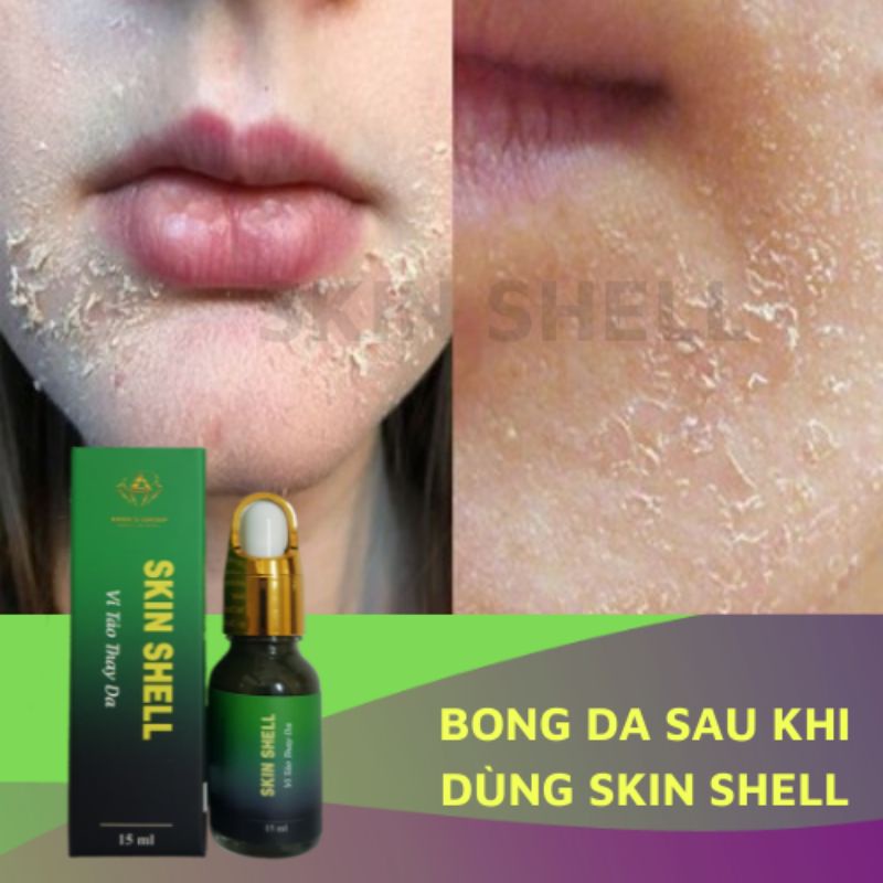PEEL DA VI TẢO SKIN SHELL