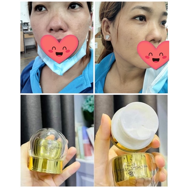 [CHÍNH HÃNG] Kem nám Huyền Phi 30g