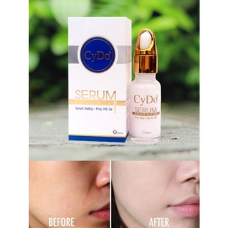 Serum dưỡng - phục hồi da Cydo