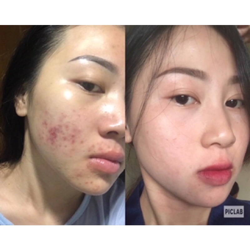 Cốt Sâm , Tái Tạo Chuẩn mạnh nhẹ theo yêu cầu