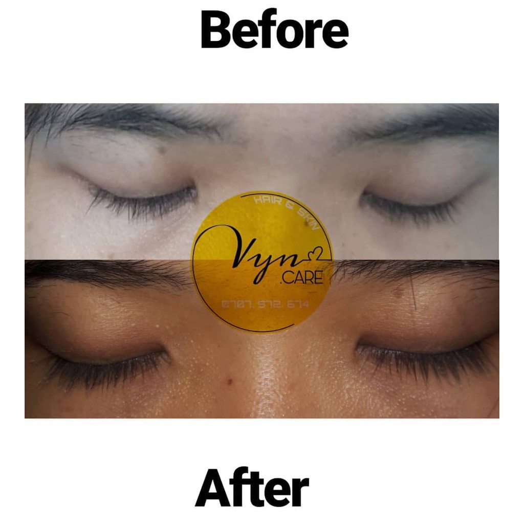 GELMI COCO (kích dài mi và mày) _ DẦU DỪA + NHA ĐAM 🎁 Tặng 1-2 viên serum tóc | BigBuy360 - bigbuy360.vn