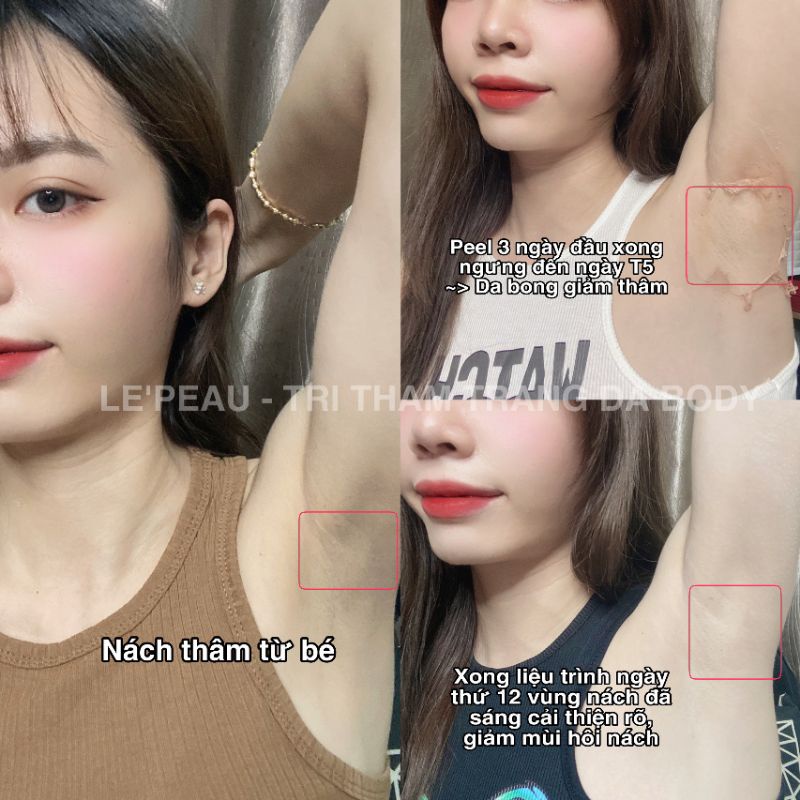 Body Peel Le'peau ⚡ Freeship ⚡peel da cơ thể 7 ngày sáng mịn.