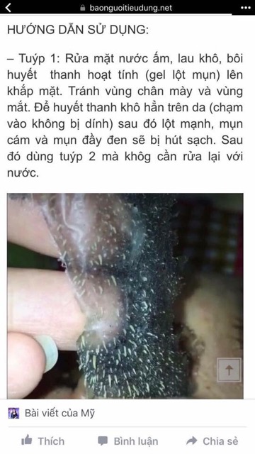 BỘ ĐÔI TRỊ TẬN GỐC MỤN CÁM - MỤN ĐẦU ĐEN NELLY.P 