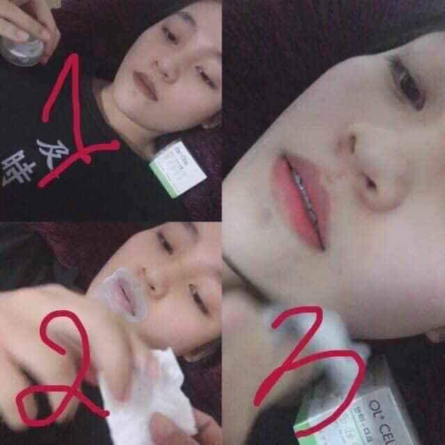 Kem thâm nách ol cell ( cam kết chuẩn 100%, sả giá kho) | BigBuy360 - bigbuy360.vn