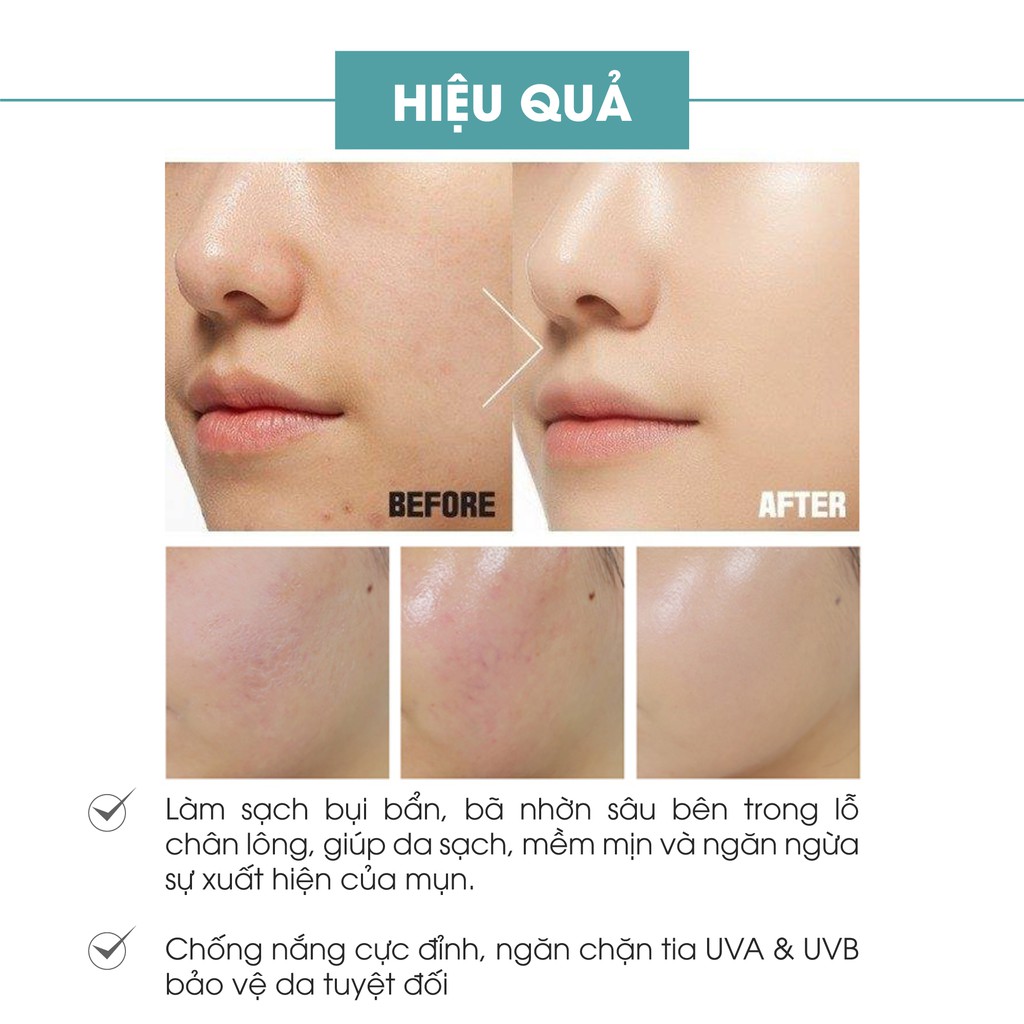 Combo 2 sữa rửa mặt tạo bọt Truesky (sữa rửa mặt nha đam trắng da 60ml + sữa rửa mặt than hoạt tính ngừa mụn 60ml) | BigBuy360 - bigbuy360.vn