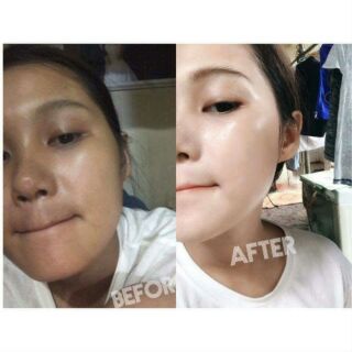Ủ kén tằm trắng da