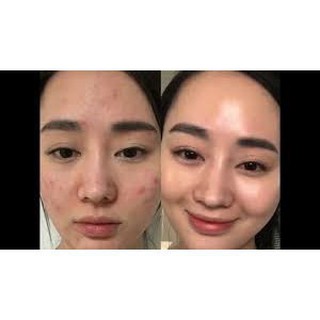 Kem AHA-BHA-PHA 30 Days Miracle Toner 60g