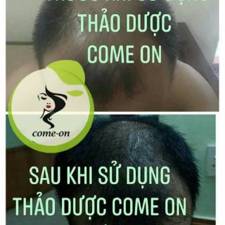 Dầu gội Thảo Dược Come on