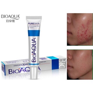 Xóa sạch nỗi lo về mụn với kem trị mụn và sẹo thâm bioaqua 30ml