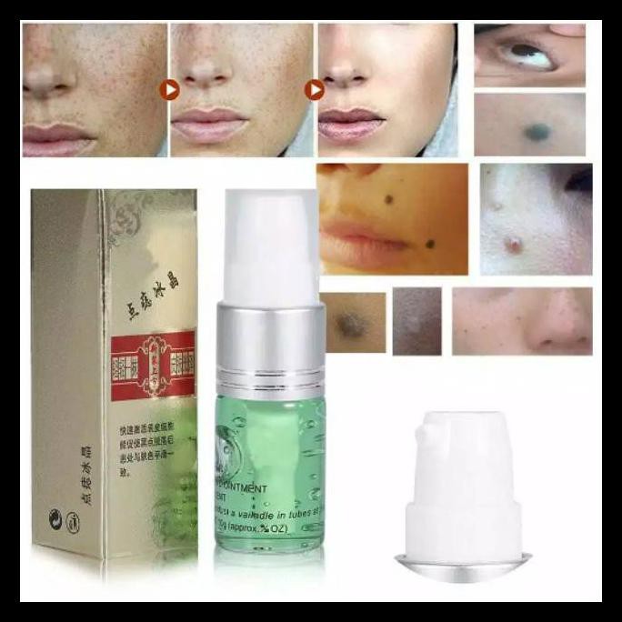 (hàng Mới Về) Serum Trị Mụn / Tàn Nhang / Đốm Đen / Nếp Nhăn Chiếu Laser Pasca