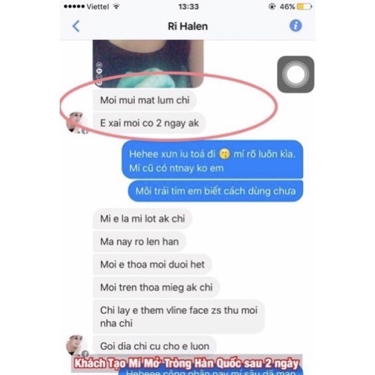 Tinh chất Miracle Pháp tạo mắt 2 mí, mở tròng mắt siêu hiệu quả (10ml)