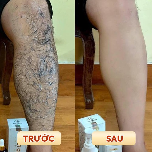 [Hàng Cao Cấp] - Combo Kem Tẩy Lông Huyền Phi Triệt Sạch Bất Chấp Các Loại Lông | BigBuy360 - bigbuy360.vn