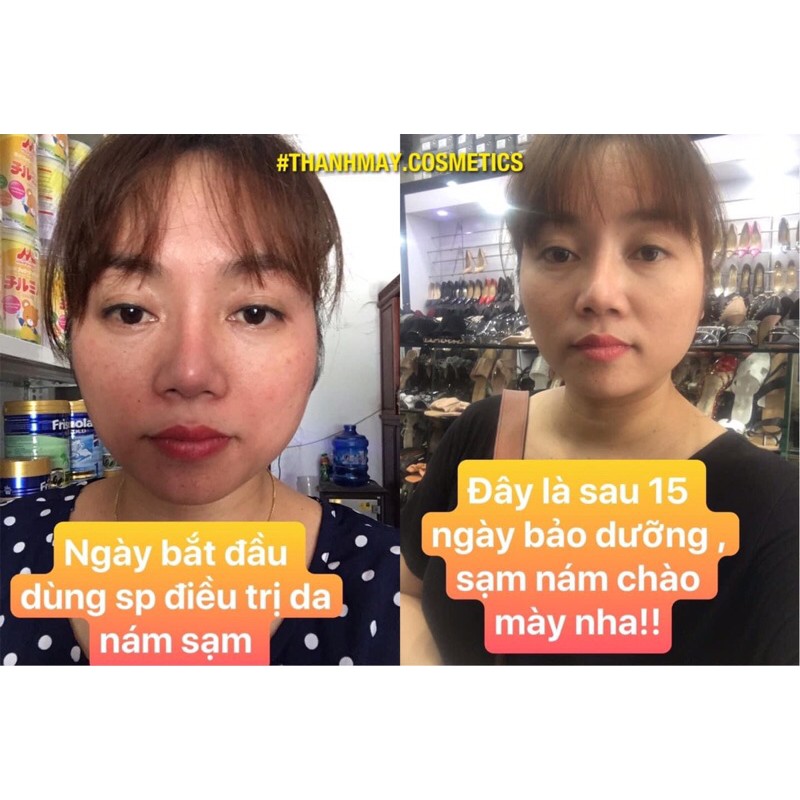[HÀNG CHÍNH HÃNG] FACE TRẮNG DA MÂY CREAM | BigBuy360 - bigbuy360.vn