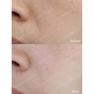 "Nước thần" tái tạo da L'Oreal Crystal Essence