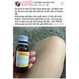 Kela lotion 60ml