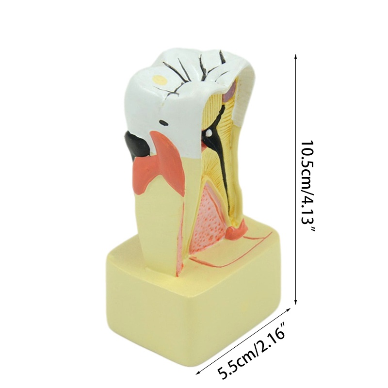 blg Dental Model Periodontal Disease Analysis for Dentist Teaching Dentistry Clinic