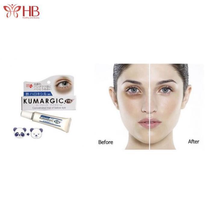 Kem Dưỡng Mắt Kumagic Eye Nhật Bản Giảm Thâm, Giảm Nhăn, Ngừa Lão Hóa vùng mắt | BigBuy360 - bigbuy360.vn