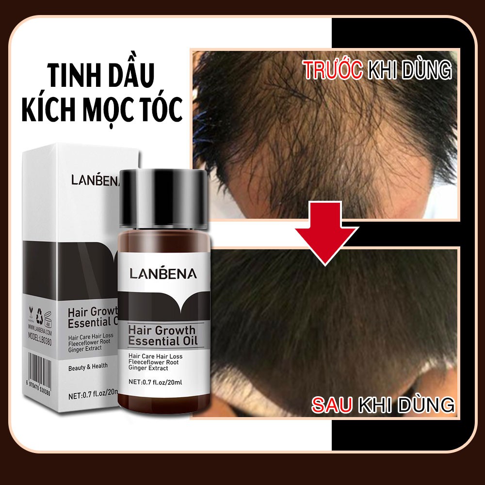 [ Mới ] LANBENA Dung Dịch Kích Thích Mọc Tóc Dưỡng Tóc Chuyên Sâu Tóc Mọc Nhanh Giảm Gãy Rụng chai 20ml