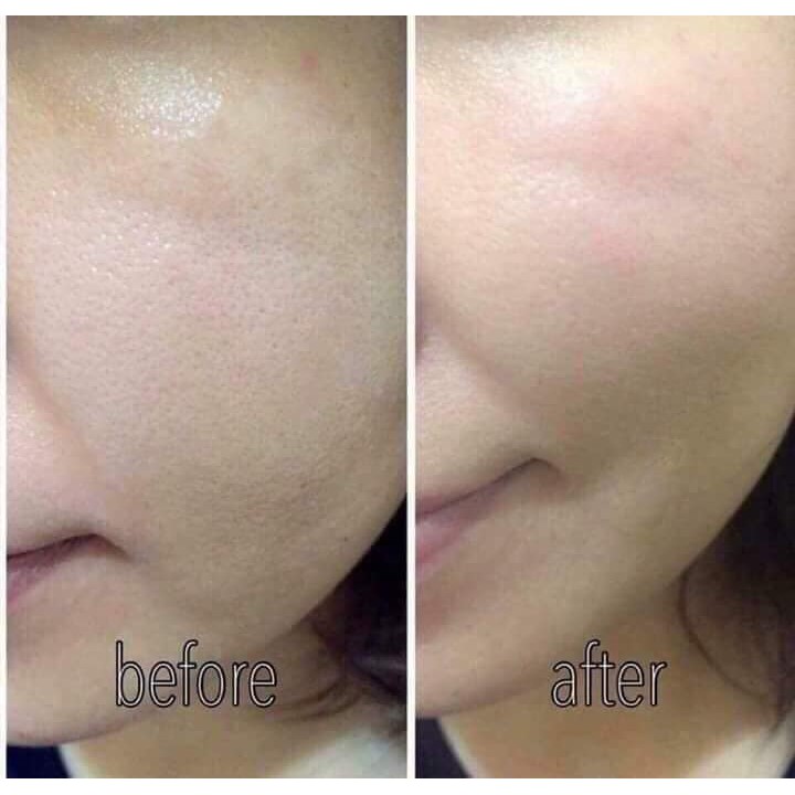 Full sét Tế bào gốc Dr. innoderm nâu và trắng 10 ống
