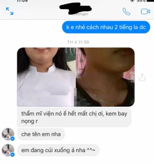 Kem tan mỡ mặt Vline PK Diet