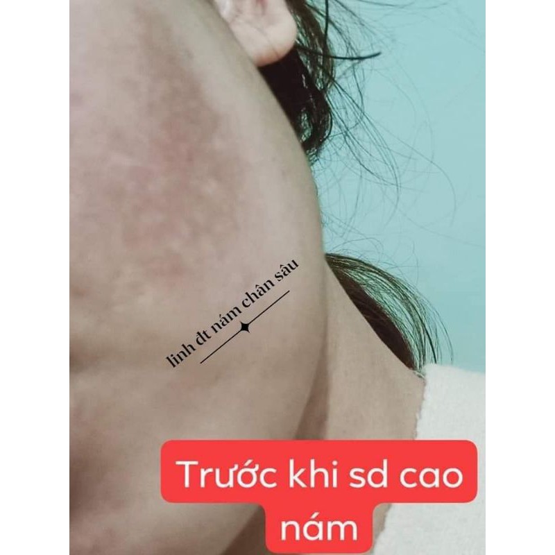 Dr.sen Cao Nám Sen Spa