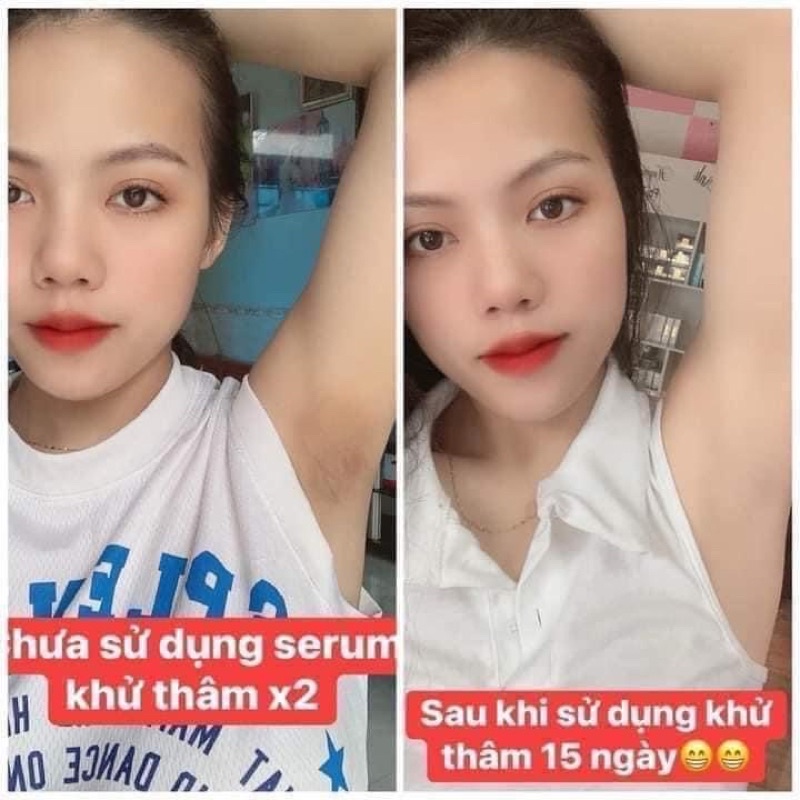 Tinh chất serum mờ thâm sau 2 tuần nano aha