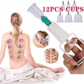 Máy Cạo Gió Giác Hơi,Bộ Giác Hơi Không Dùng Lửa 12 Món Loại Tốt, Chuyên Dụng Cho Các Vùng: Lưng,Cổ Gáy, Vai, Mông